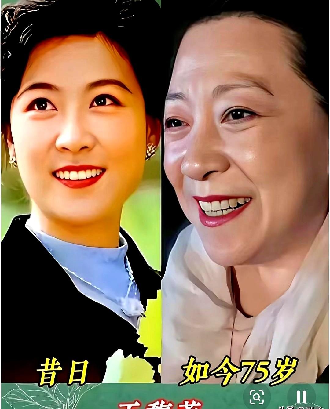 终于懂了，为什么说潘虹她们那代人，脸上没有一丝医美狠劲。年轻时个个是银幕上的