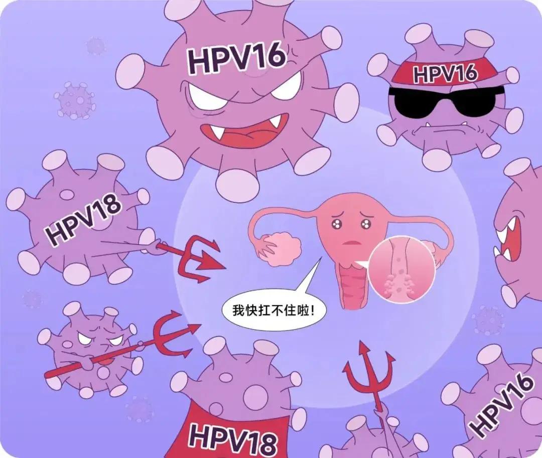 感染了HPV，这2种情况最危险！希望你不属于其中任何一种查出HPV阳性后，很