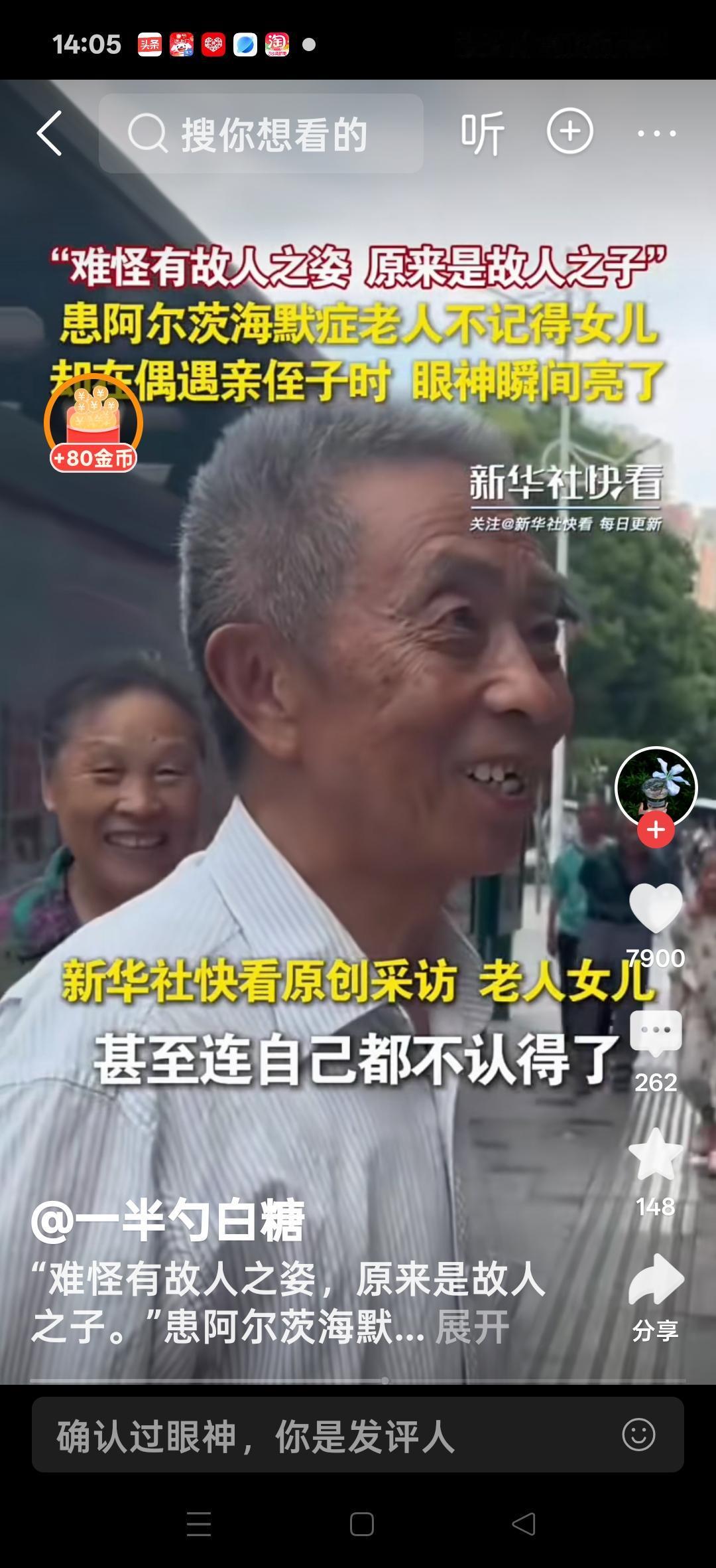 患阿尔茨海默症的老人记不得女儿，却在偶遇亲侄子时，眼睛瞬间亮了，看到侄子后，立马