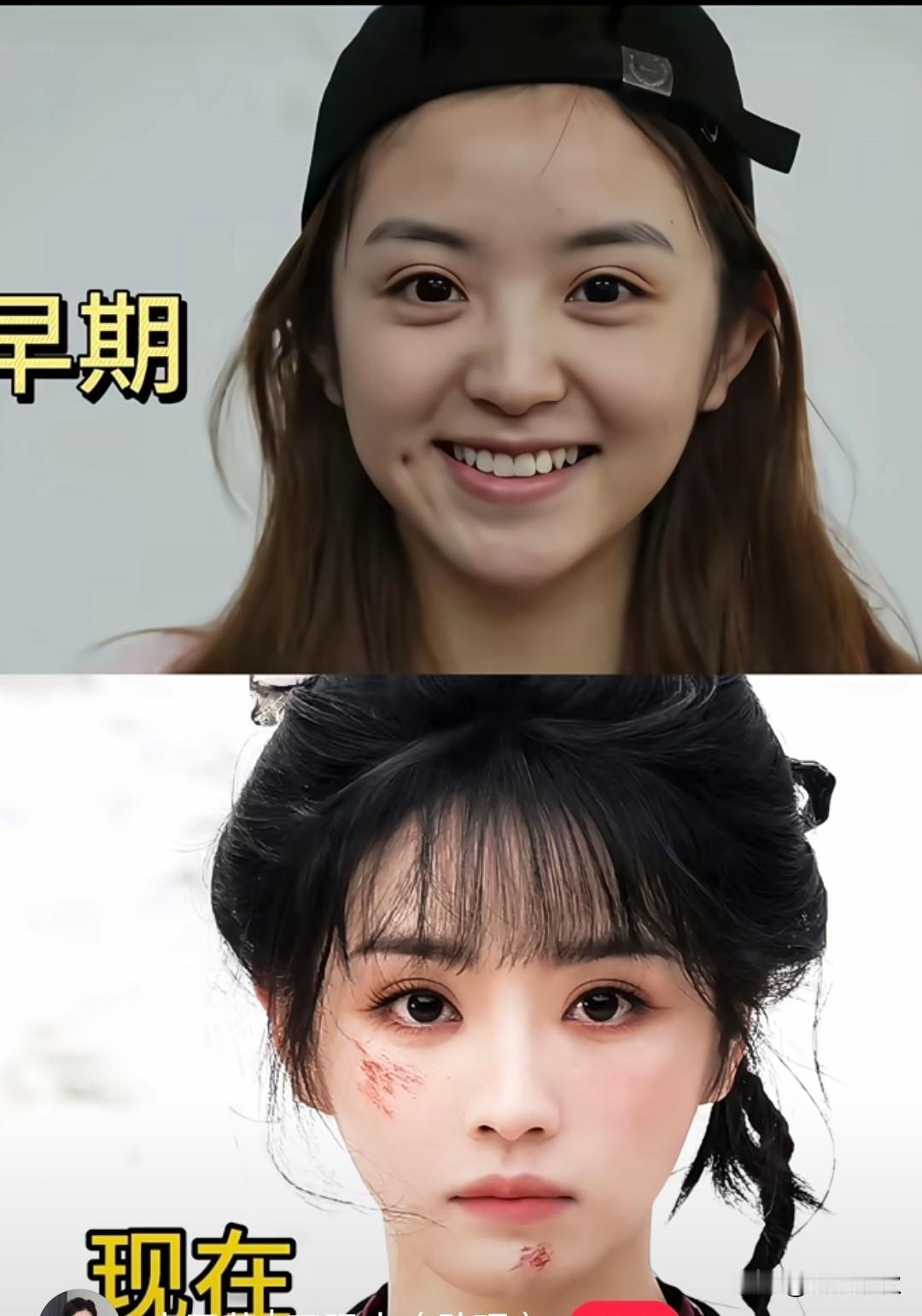多么神奇！田曦薇早期和现在完全不像是同一个人之前脸庞大气饱满、五官协调现在