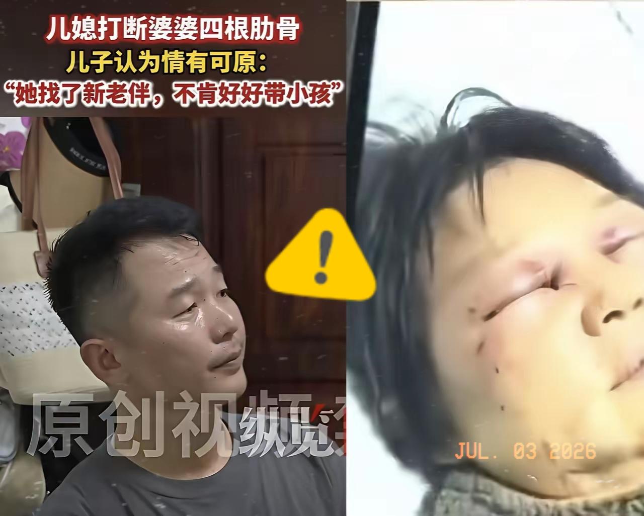 嘉兴婆婆遭殴打一事看得人胸口发堵，可比起施暴的儿媳，是全程无动于衷的儿子！只因