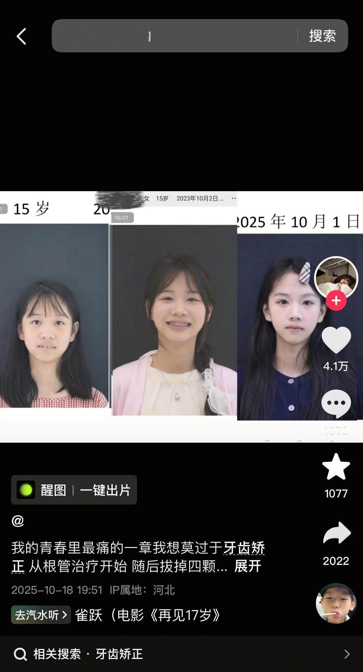 这是真的值💫​​​