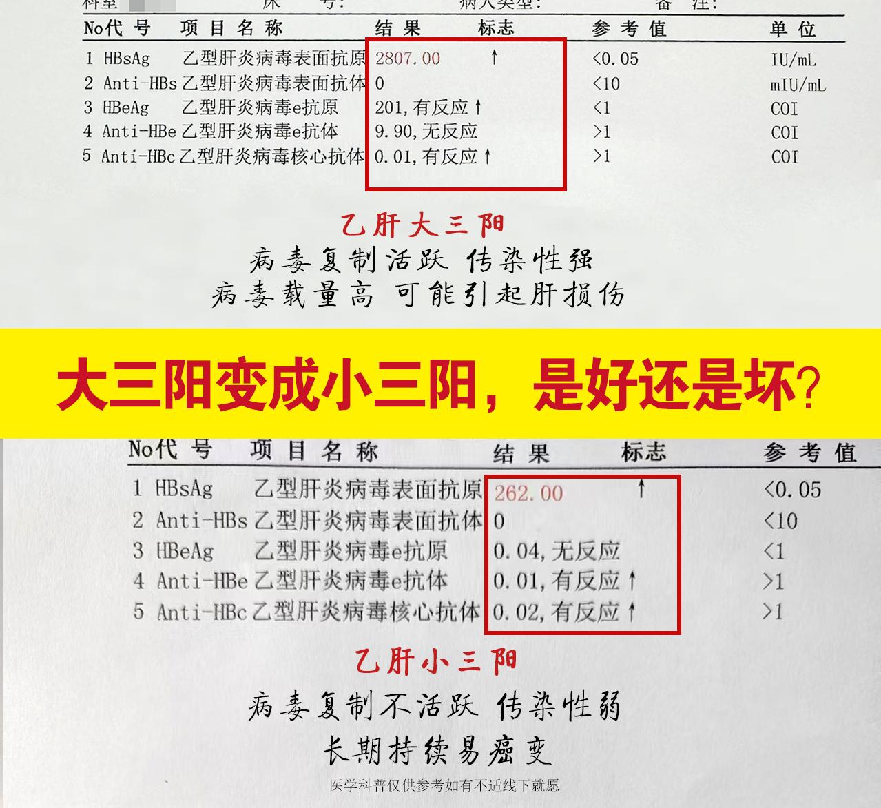 乙肝患者大三阳转小三阳是好还是坏？乙肝患者通过积极抗病毒治疗，大三阳转...