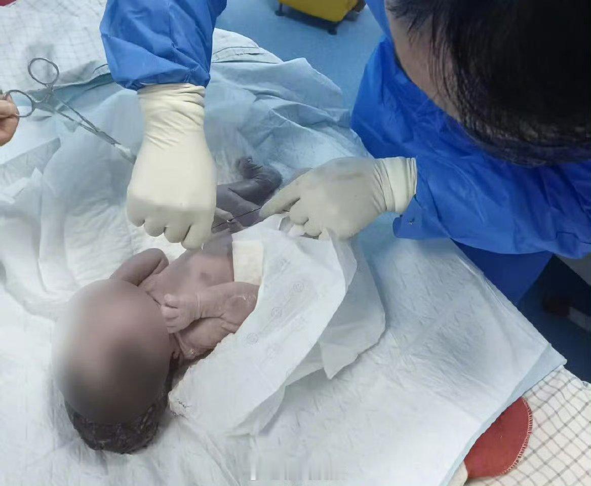 腹痛入院才知怀胎十月女子已成功分娩这真是最大的幸福，恭喜恭喜！别人怀孕都很难，