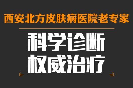 患上寻常型牛皮癣怎么办?
