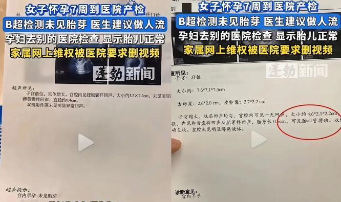 “到底听谁的？今年8月，山东一女子怀孕七周去做产检，却被告知“未见胎芽”医生建议