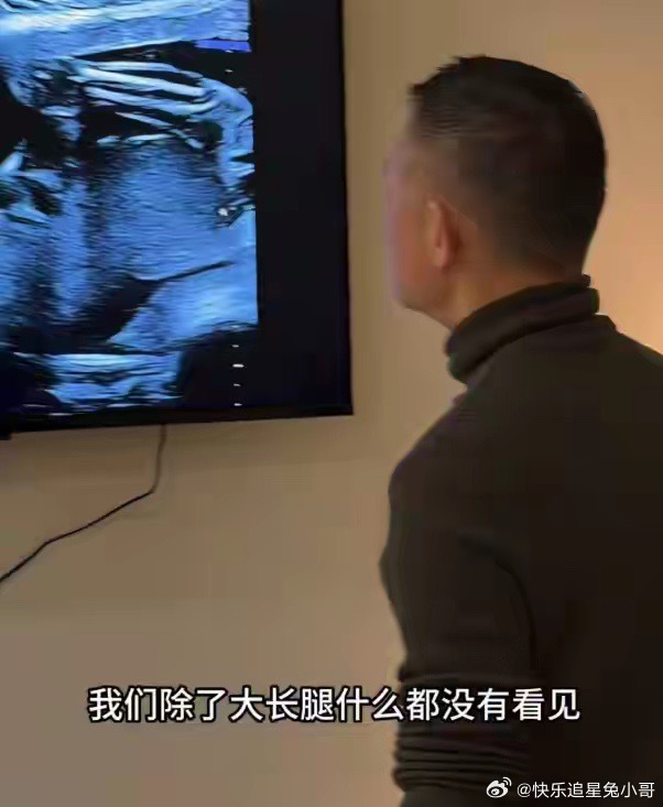 四少汪雨陪娇妻产检，订15万私立医院套餐，B超看宝宝腿长耳朵大！