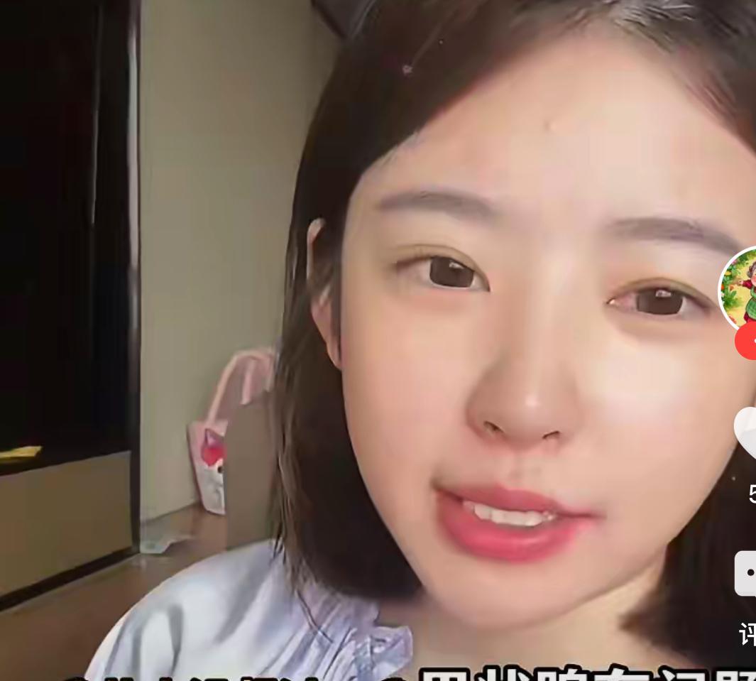 天呐，王思聪前女友，黄一鸣得了甲状腺3级，离甲状腺4B只差一步之远，为什么那么年