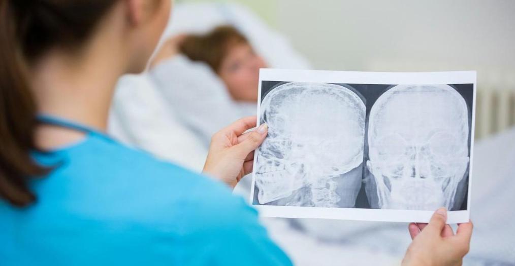 越来越多人做脑部CT检测！专家：查一次脑部CT，或会有这5益处脑部CT现在做