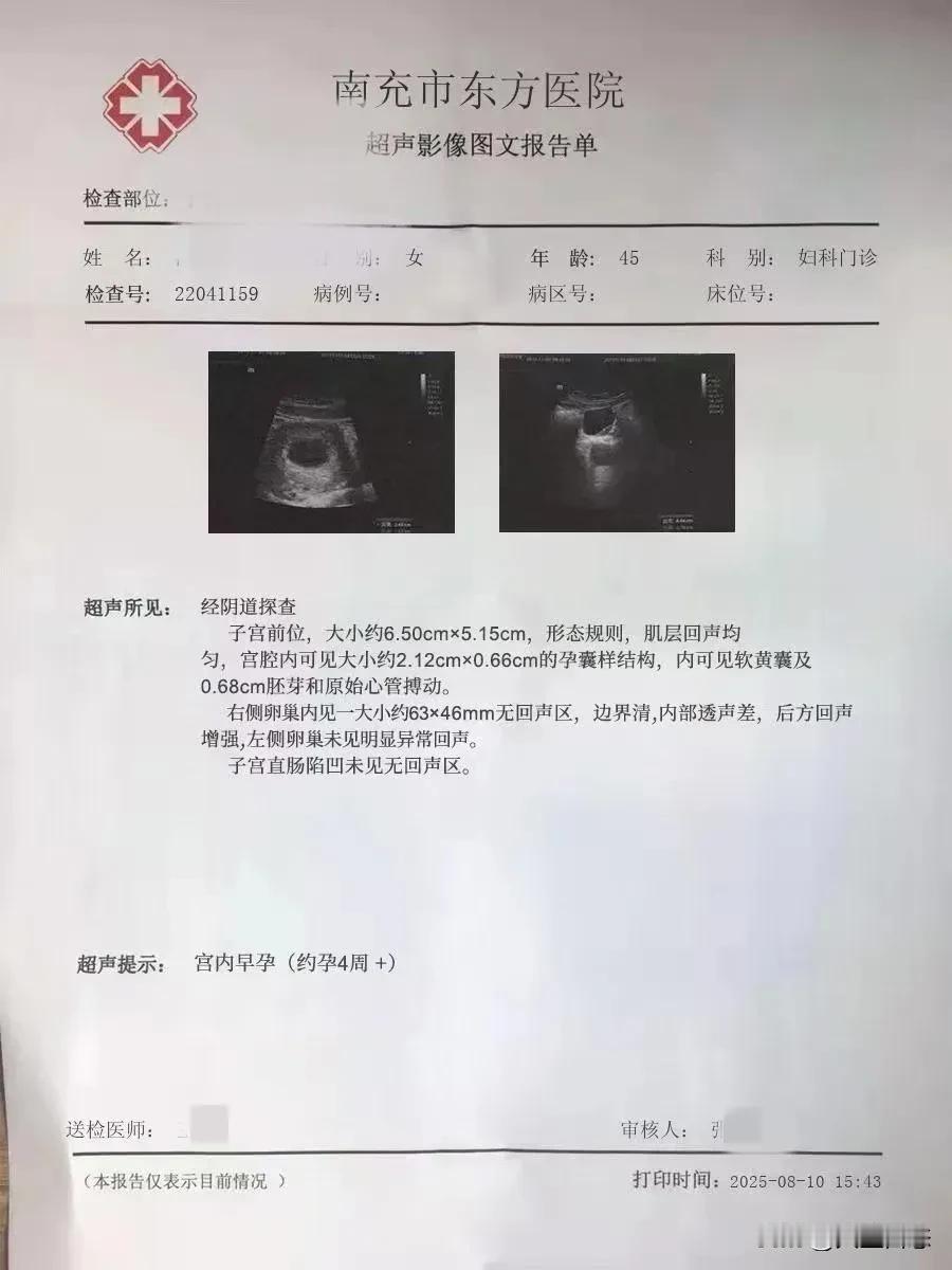 45岁怀孕是“喜”还是“险”？6cm囊肿与4周胎芽同现，医生紧急提醒：需要谨慎