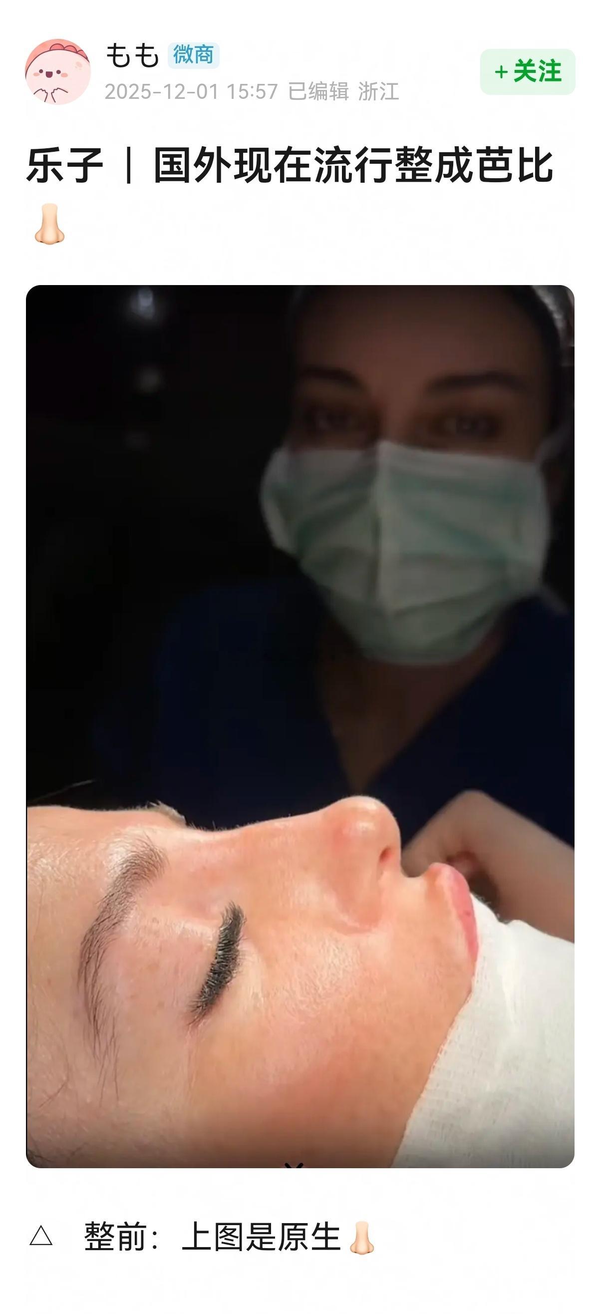 我不理解，原来的鼻子多好看，整容都有审美倒退吗？！！