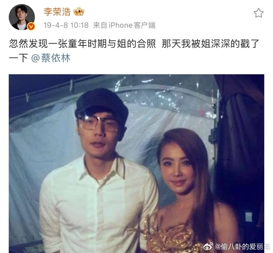 李荣浩是一个幽默的歌手…我想问当时疼不疼