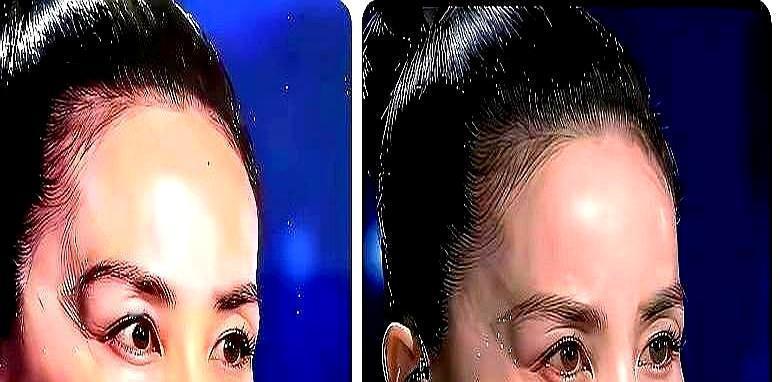 王菲脸上两条诡异蓝光，竟不是特效。春晚镜头一拉近，所有人都愣了。王菲脸颊两