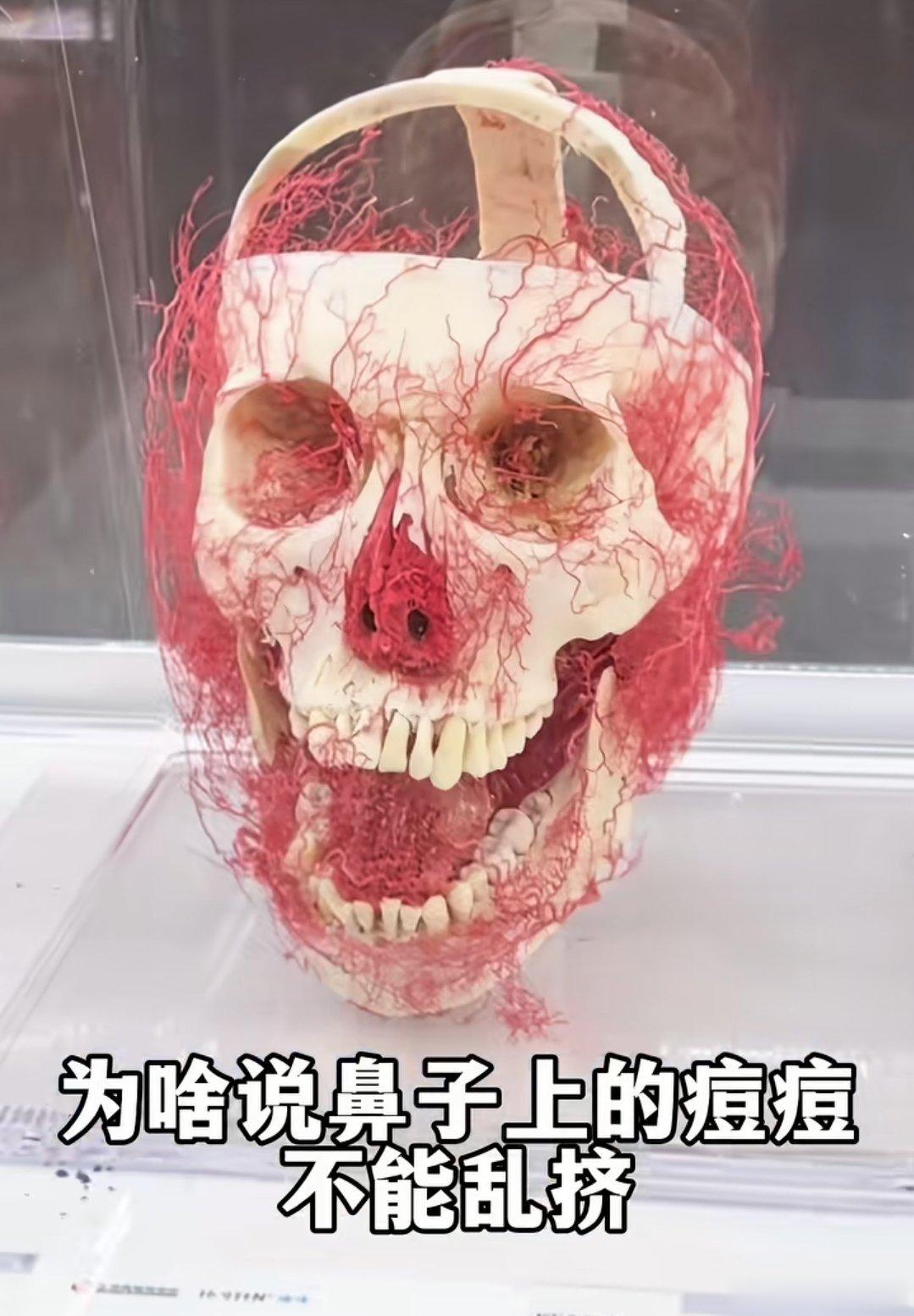 为什么说鼻子上的痘痘不能乱挤​​​