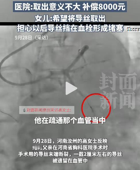河南汝州，近日，62岁大爷做手术时，2cm导丝意外断裂掉进血管，女儿担心导丝挡在