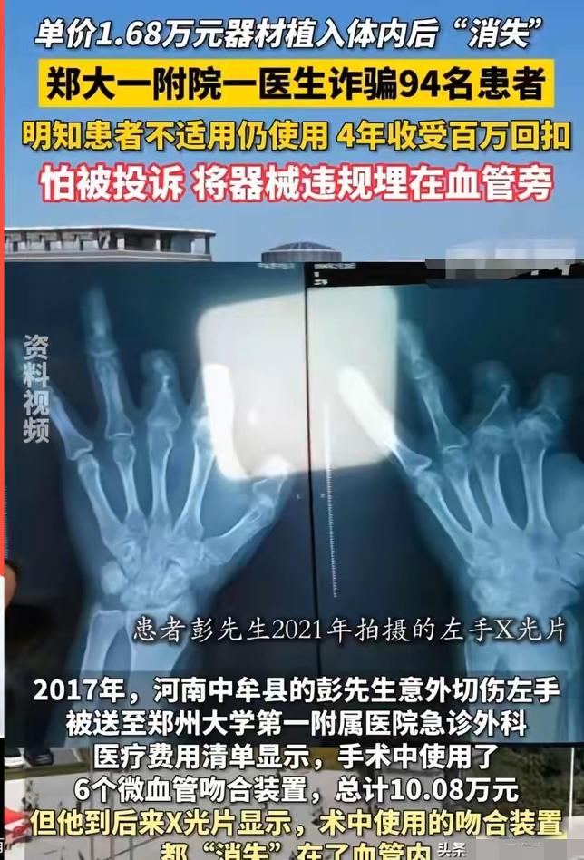 郑州大学第一附属医院有个叫王福建的医生，因为坑骗病人，最近被判了12年。简单