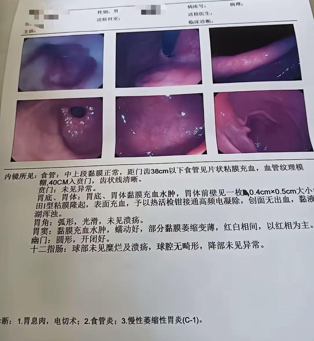 今天的患者是一位46岁的货车司机，方向盘的背后是坚持了多少个日夜的胃部隐痛。