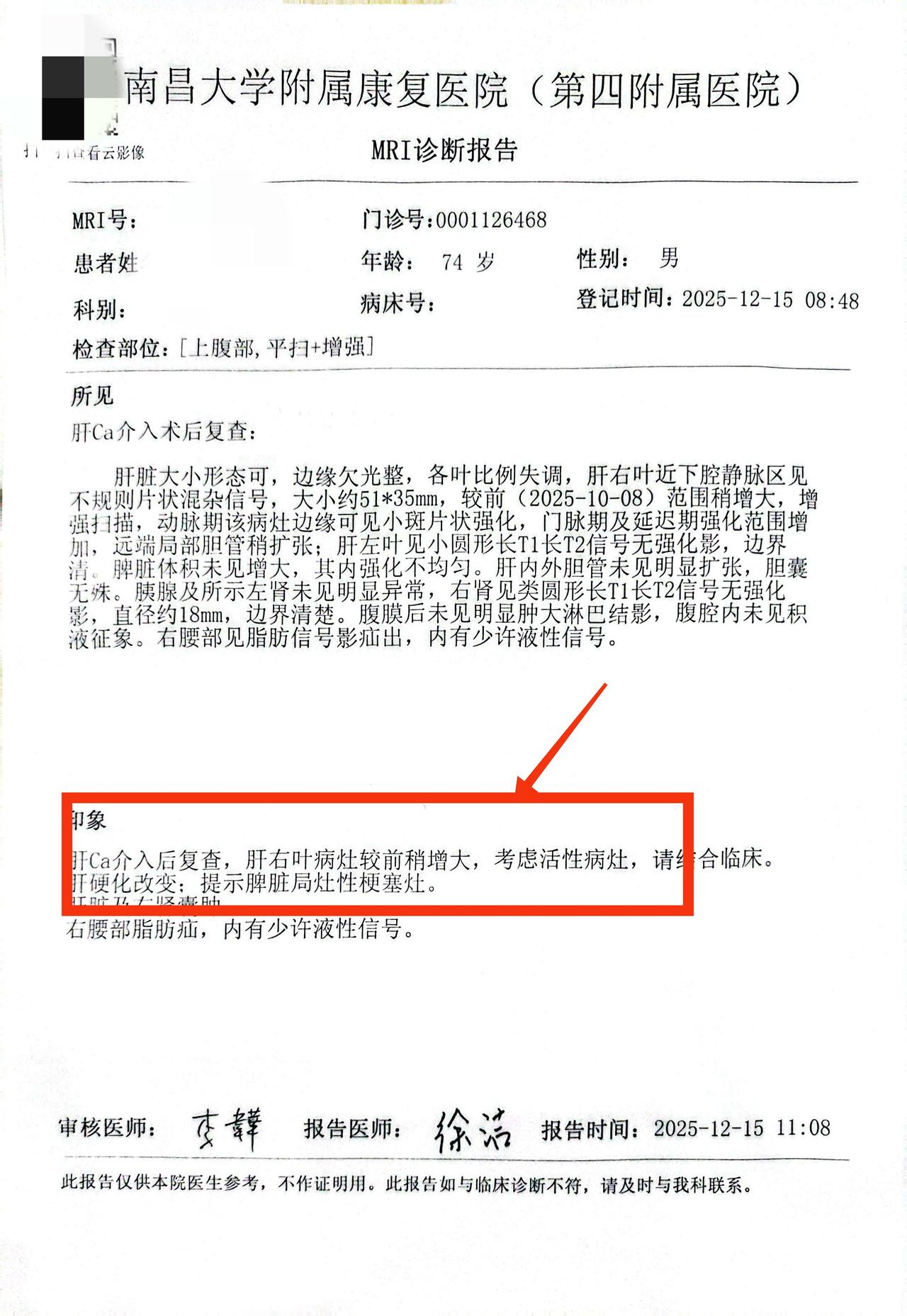 这是我们上周才治疗的一名晚期肝癌患者，病人74岁，来自江西，患者确诊原发性肝癌后
