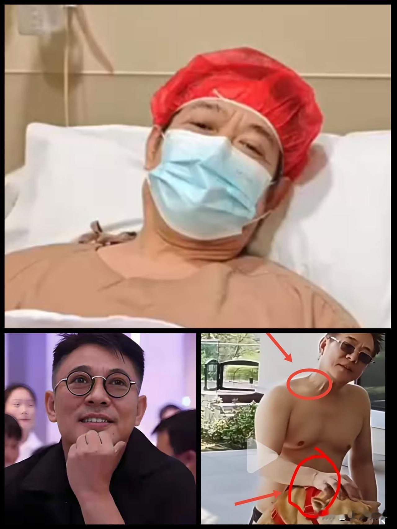 李连杰大病后突然“返春”不是换了心脏，也不是换了血，更不是p了图，而是他