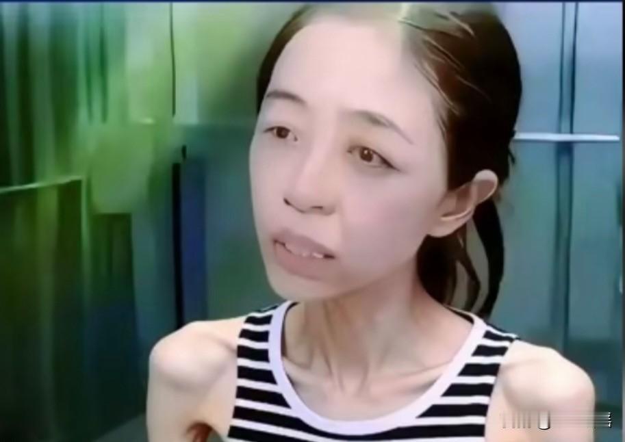 金母目前身体消瘦非常严重，前段时间知道金毛被判处吃米后，一时受打击后，身体从此