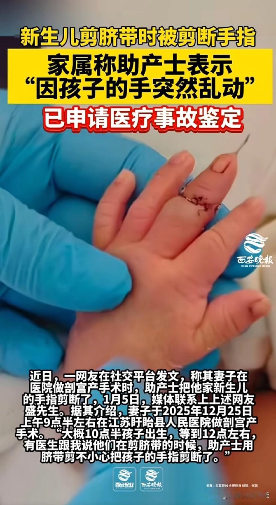 当父母的得多心疼啊！江苏，一男子称妻子在医院做剖宫产手术时，接生医生因为操作失误