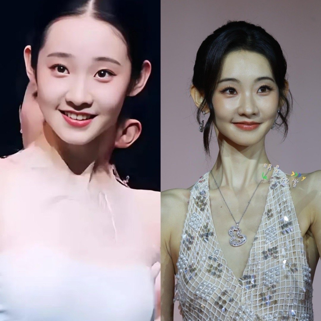 张艺凡瘦到断崖式衰老了，肌肉走向都变了​​​