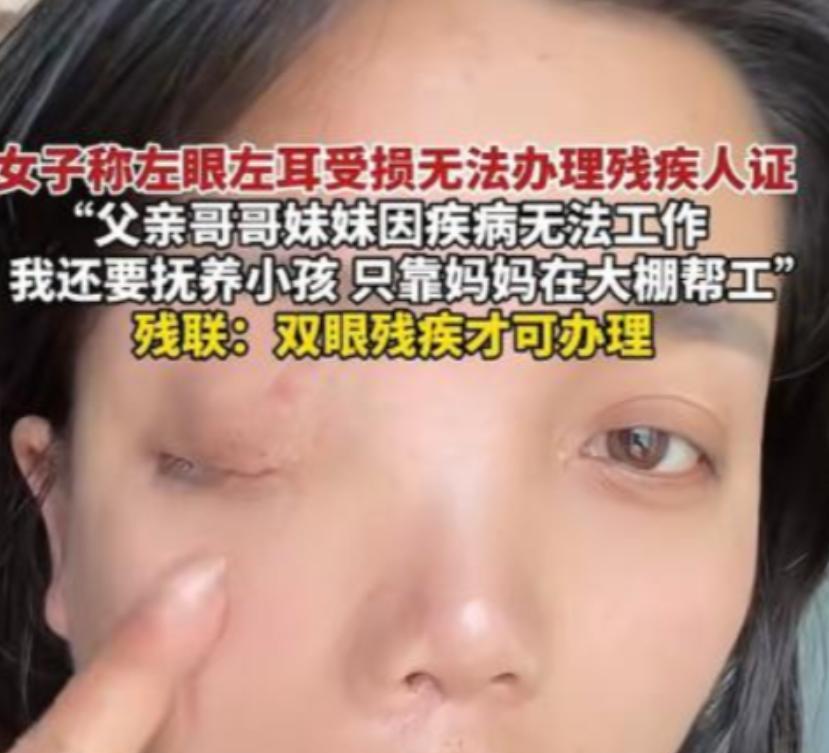 安徽蚌埠，独眼女子去办残疾证，却被工作人员告知还有一只眼睛是好的，办不了残疾证。