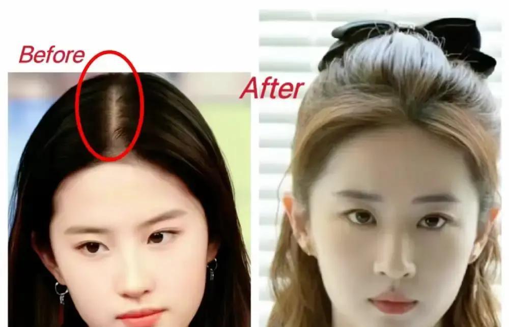 15万，够我老家一家人吃两年。刘亦菲那顶假发就这个价，瑞士手工的。网上又翻出