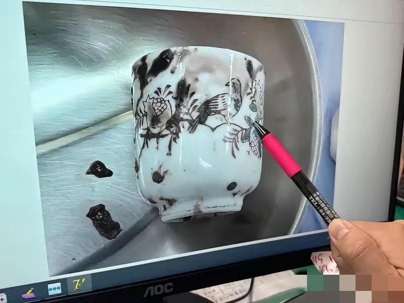 台湾台中，一男子将陶瓷杯塞入肛门，这个陶瓷杯宽6厘米、高8厘米，塞入原因男子表示