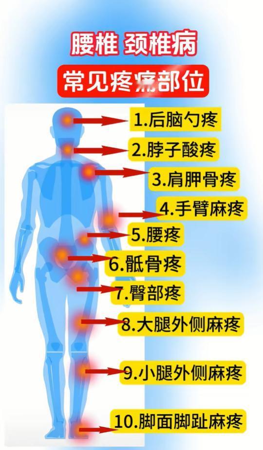 后脑勺疼、手脚发麻？多半是颈腰椎压迫导致