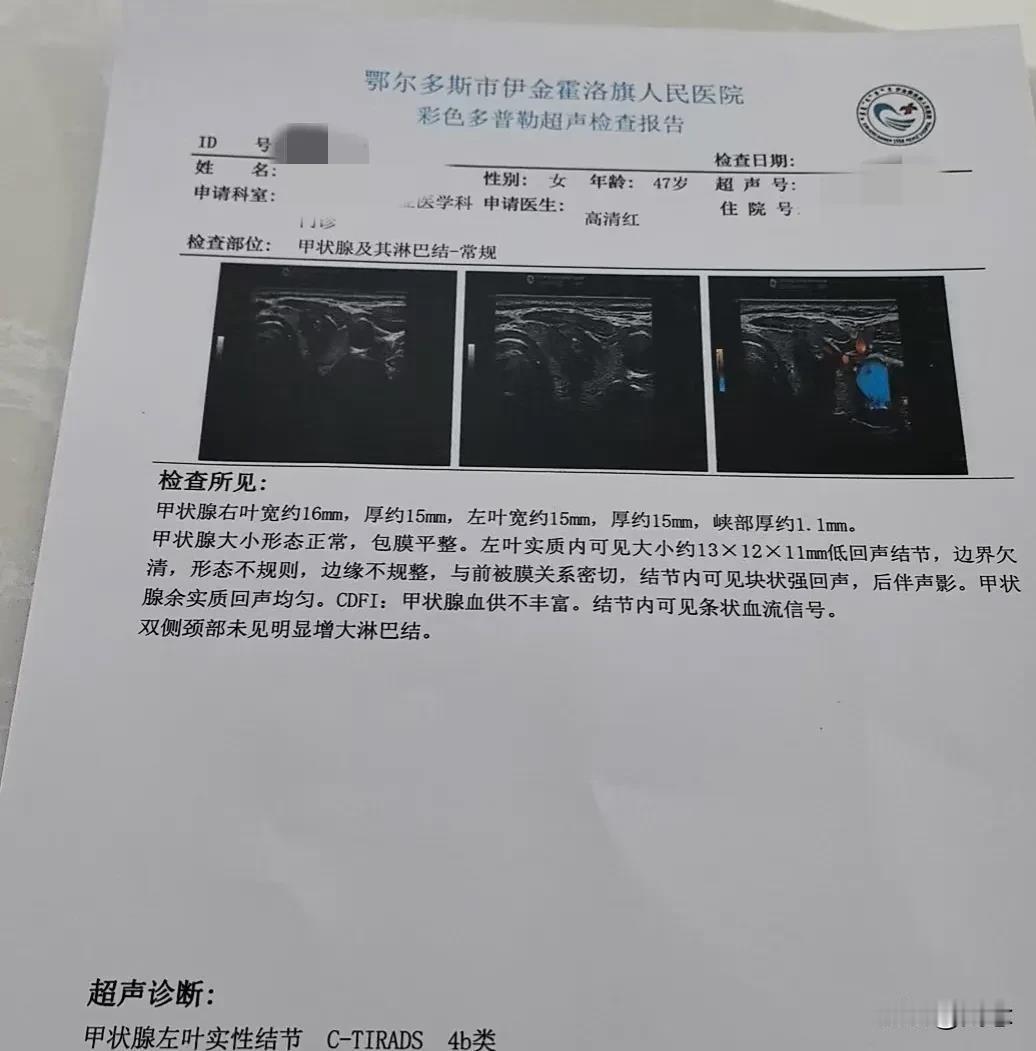 北京协和医院为什么厉害？为什么这么牛？看完这两份报告你就知道了，同一个人在两家医