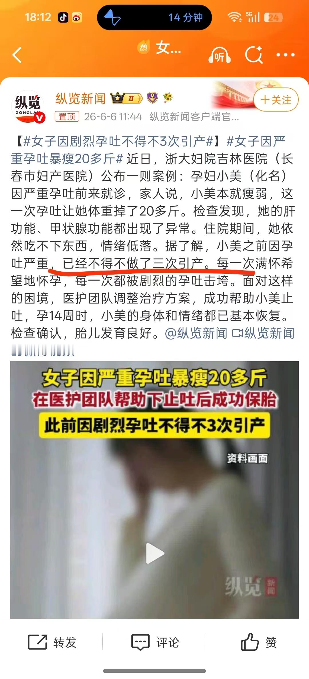 女子因剧烈孕吐不得不3次引产这种特别罕见的类型，往往都是由于子女宫的加入，给