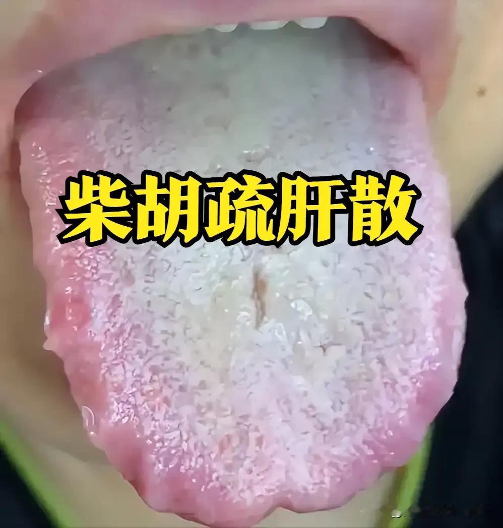 柴胡疏肝散：疏肝解郁第一方，专解肝气郁结的“郁堵”烦恼大家好，我是陈大夫！