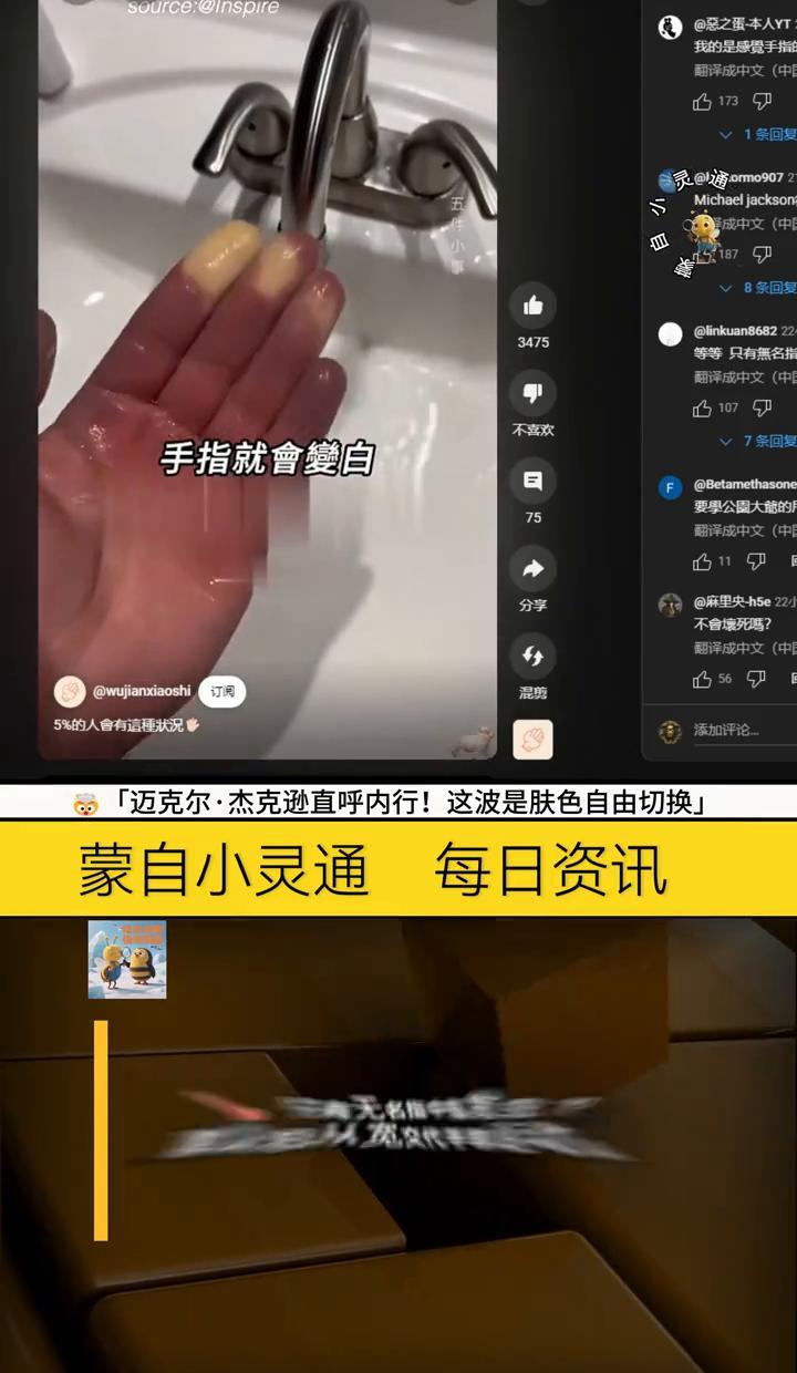 手指一冷就发白，没知觉，像冻僵的馒头。别急着泡热水，烫了自己都不知道。这不是