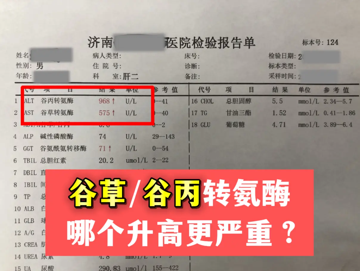 今天门诊上来了一个小伙子，刚查出乙肝，谷丙转氨酶 968，谷草 575...
