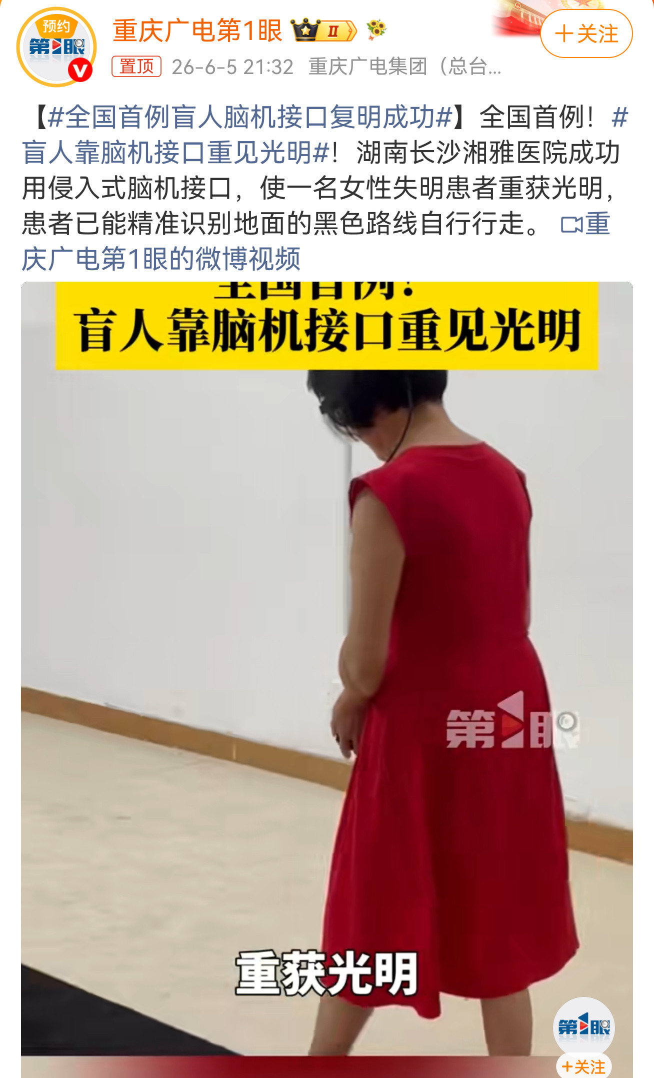 这种高科技技术值得推崇，希望能够早日推向市场，给更多有视力障碍的人带来复明的希望