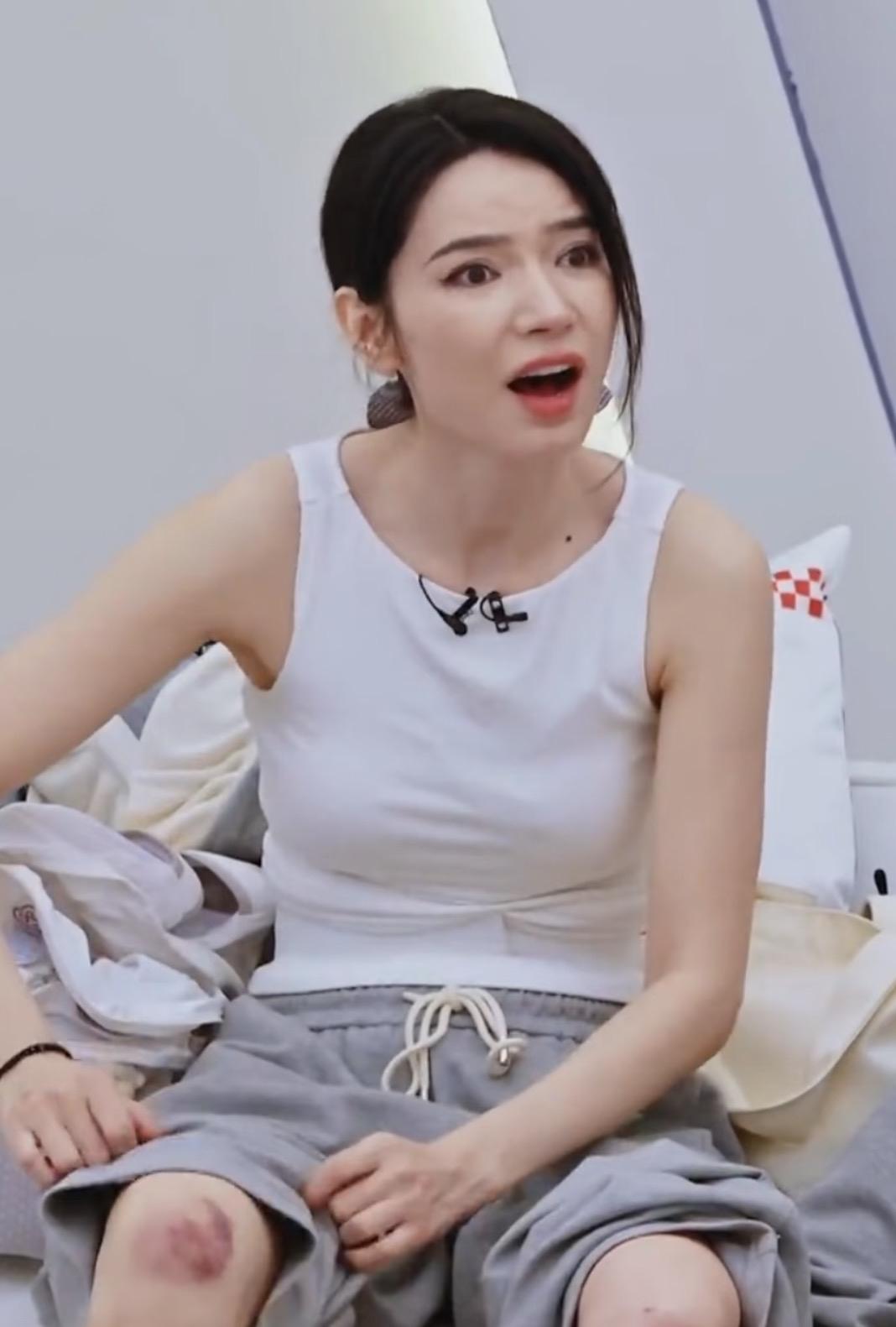 天呐，代斯膝盖上这伤，舞台上藏得真好，还特意穿了白色袜子牢牢挡住。练舞这件事，