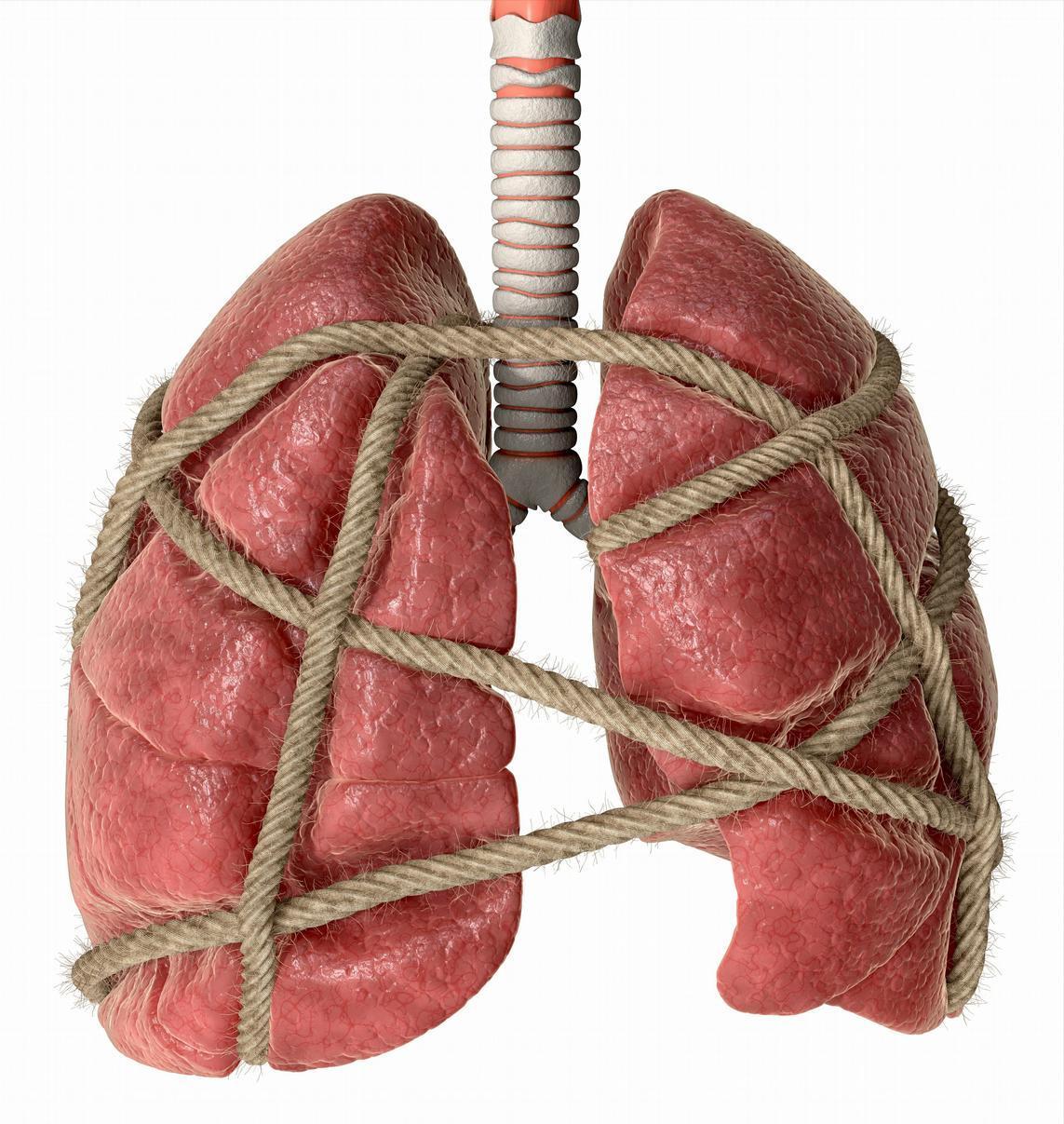 肺被困住了，不但很难把外界的空气吸到肺内，吸进来的进不了身体临床上有很多奇奇怪