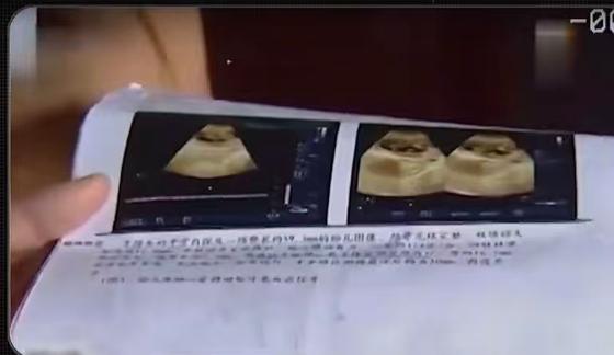 江苏31岁男子李磊，得知未婚妻吴秀秀怀孕后，非但没抓紧办婚礼，反倒打起了彩礼
