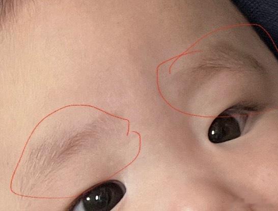玄学一则：[并不简单]看1岁以下婴儿，眉毛，来预测父母父母婚姻，如图，如果婴儿很