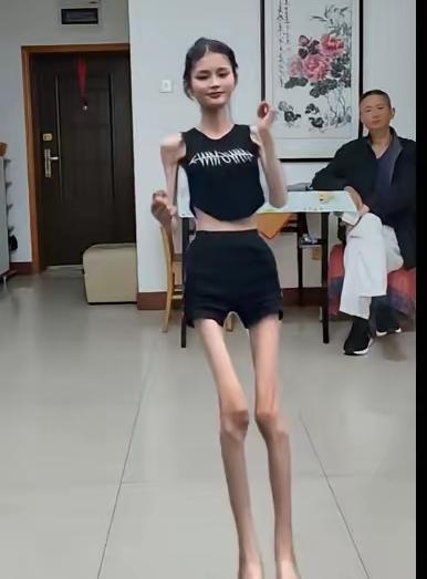 真没必要，已经骨瘦如柴了！皮包骨头还减肥真邪乎！这闺女瘦成麻秆还蹦跶，饿得前胸