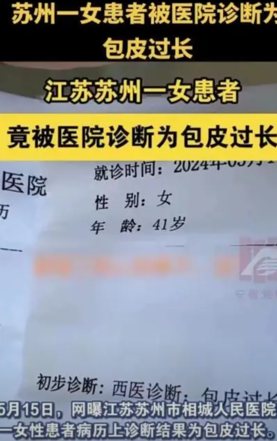 炸裂！江苏女子身体不适，去医院检查被诊断出包皮过长，院方工作人员看完诊断后大笑，