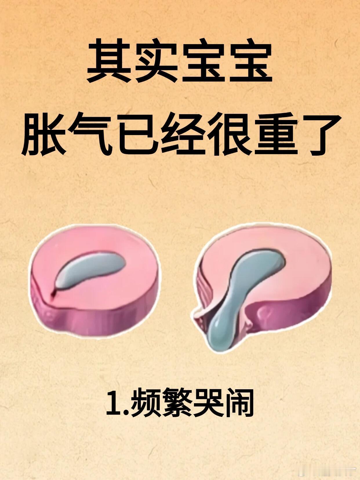 6个宝宝肠胀气的征兆夜里哼唧哭闹到凌晨、喂奶后没多久就吐奶溢奶、睡觉时小身