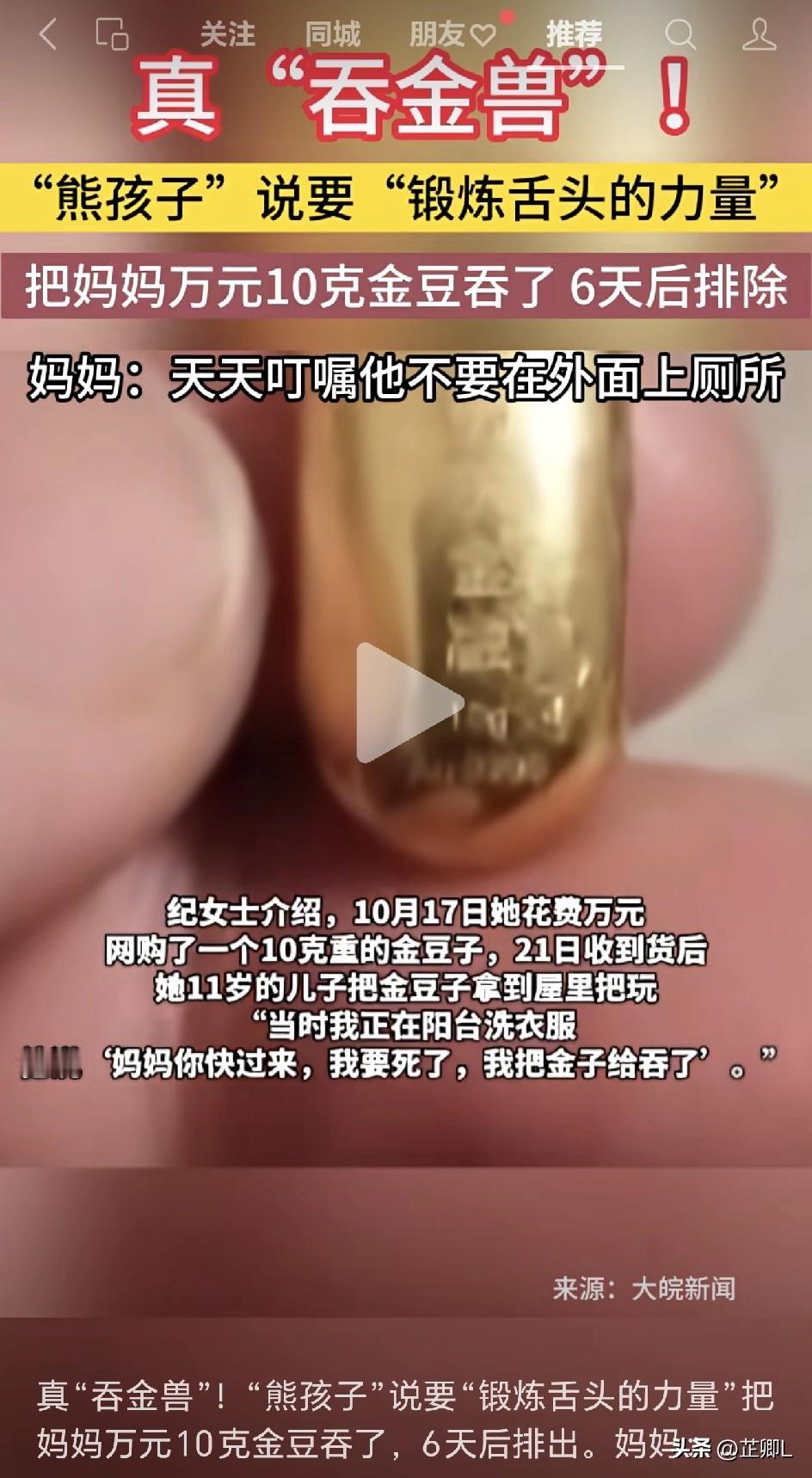 真·“吞金兽”！熊孩子为练舌功吞下10克金豆，妈妈叮嘱不准在外面大便，守候五天“