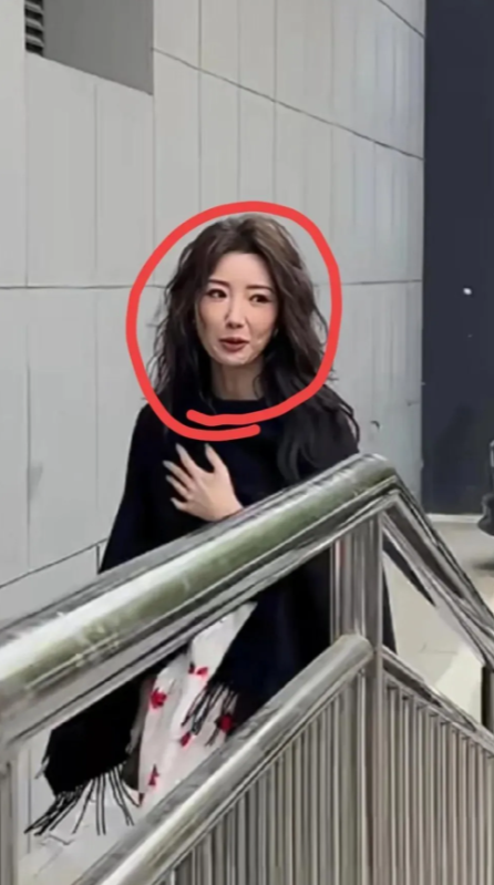 真搞不懂毛晓彤，明明这么漂亮了，还要去做医美，现在岁数大了后遗症紧随着就来了，比