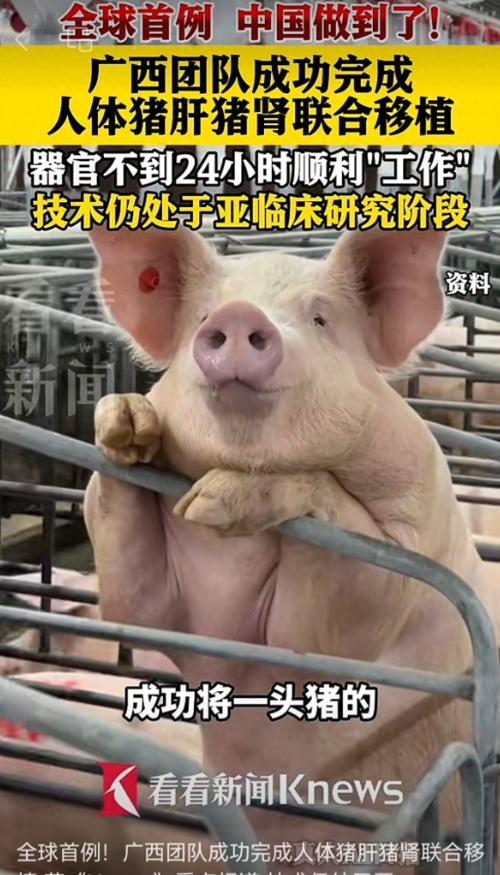 全球首例！6月2日大河报报道，广西一帮医生，把整副猪肝脏外加两个猪肾，一次性移植