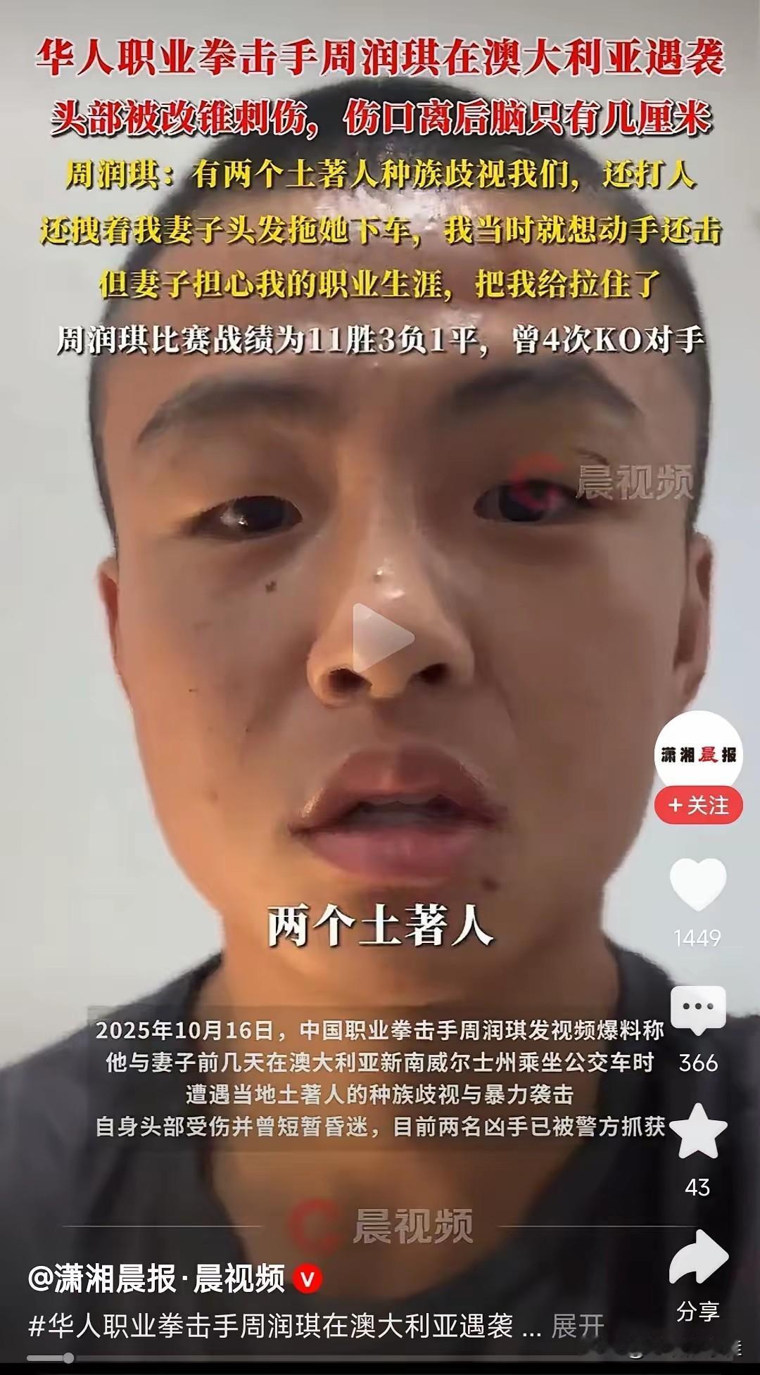 周润琪现在估计肠子都悔青了！他后悔的不是移居澳大利亚，也不是职业生涯被迫中断