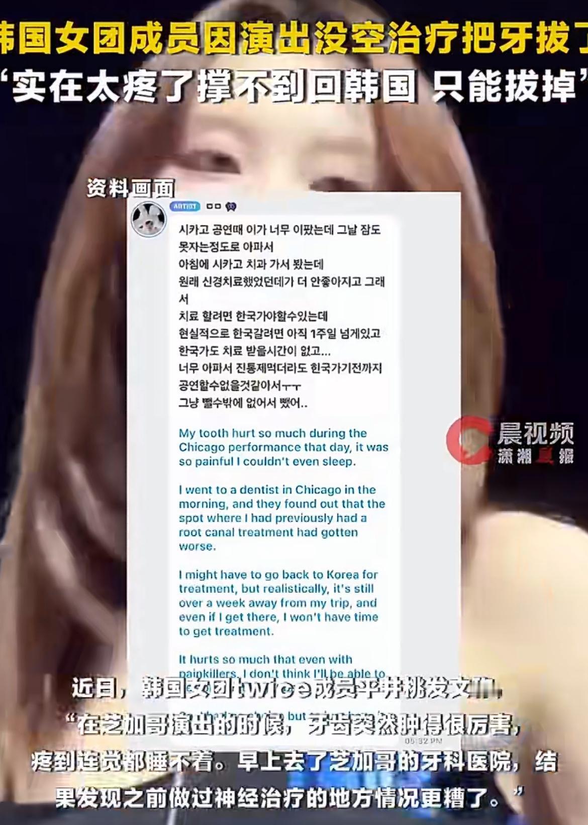 韩国女团成员因演唱会没空治疗牙齿，直接把牙齿拔了，韩国女团twice成员在演出的