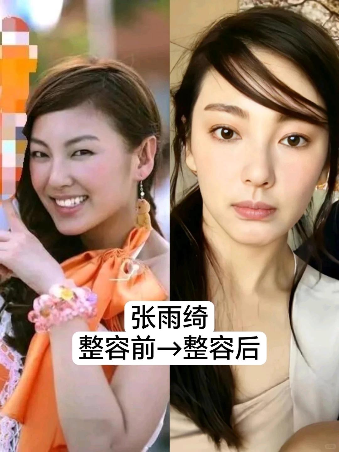 盘点一下娱乐圈整容的明星！