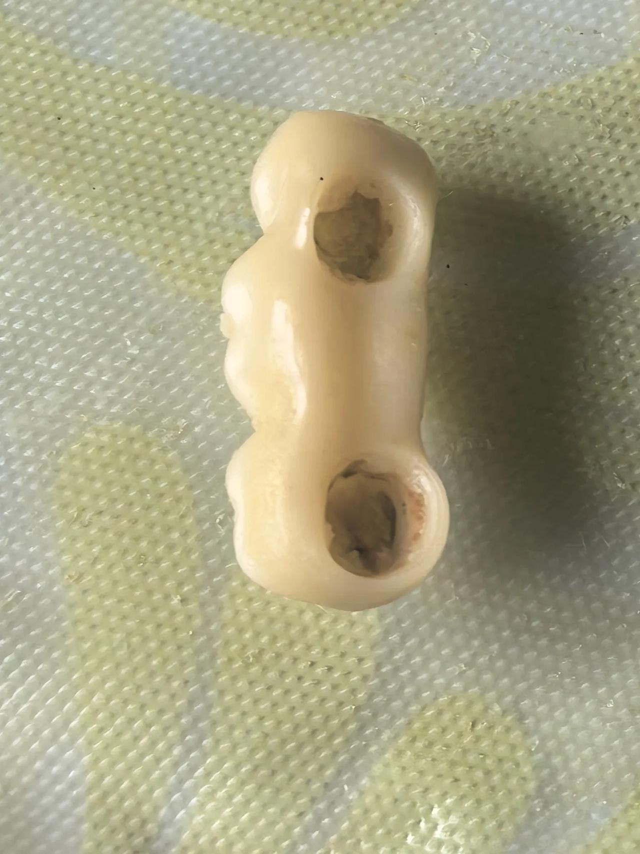 奥体中心牙科连锁店，具体名字我就不说了，实际人家服务态度挺好，一次成型，没有任何